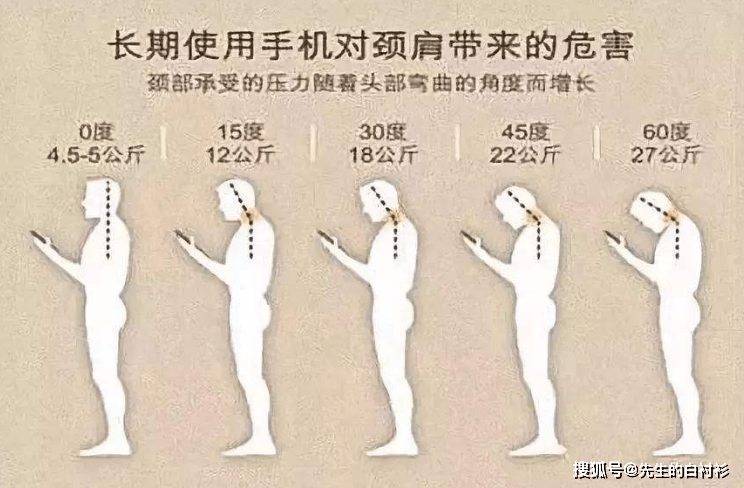 痉挛性斜颈最新治疗观点及29日治疗进展论述