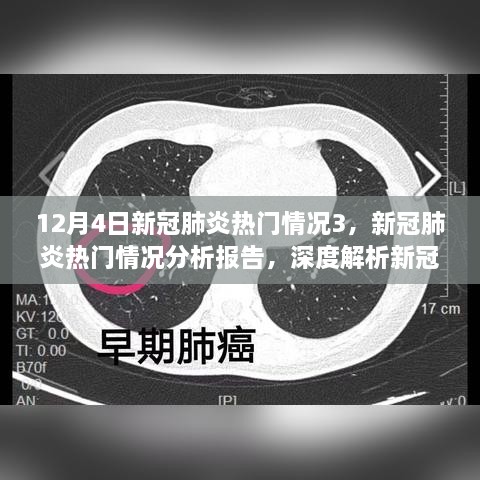 深度解析，新冠肺炎热门情况分析报告——产品特性与体验体验探讨（以新冠肺炎热门情况3为例）