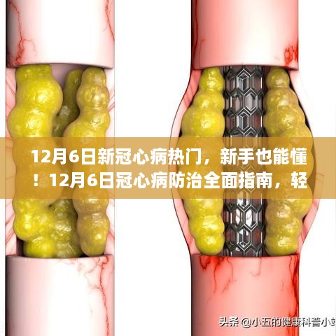 12月6日冠心病防治全面指南，轻松掌握健康技能，新手也能懂！