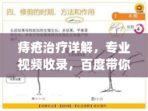 痔疮治疗详解，专业视频收录，百度带你洞悉治疗秘籍！