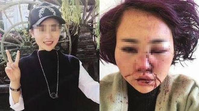 丽江女游客毁容事件后续，智能防护系统重塑旅游安全感前沿报道