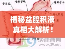 揭秘盆腔积液真相大解析！——百度权威解读