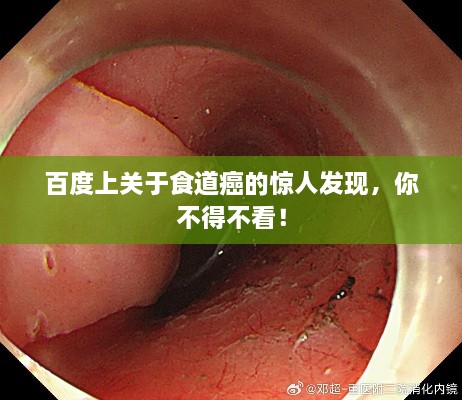 百度上关于食道癌的惊人发现，你不得不看！