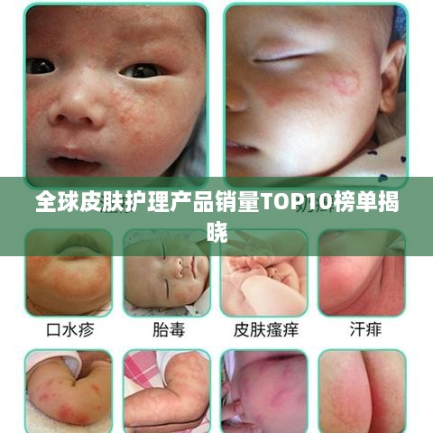全球皮肤护理产品销量TOP10榜单揭晓