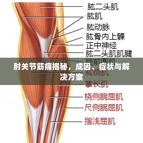 肘关节筋痛揭秘，成因、症状与解决方案